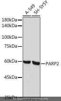 Human PARP2 ELISA Kit