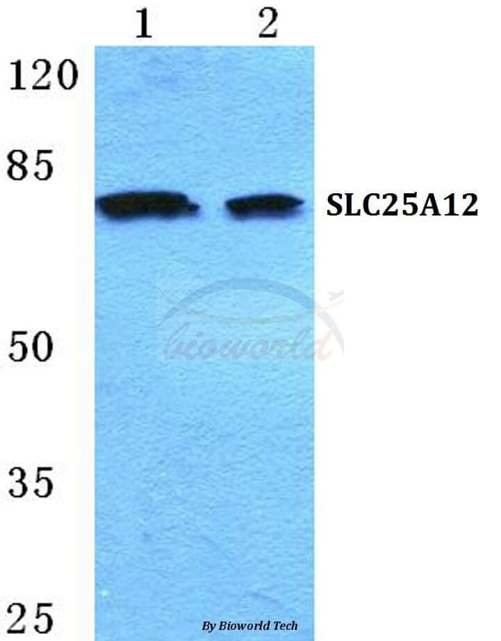 Anti-SLC25A12 Antibody
