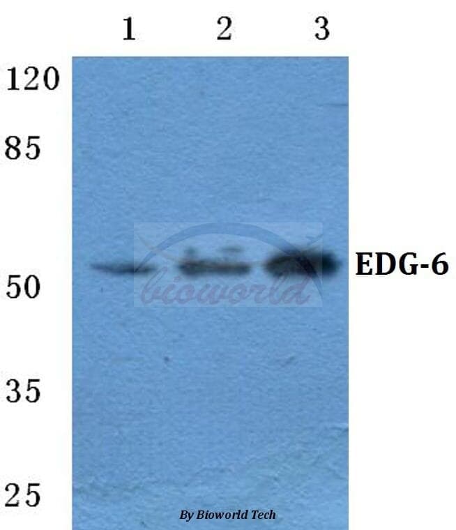 Anti-EDG-6 Antibody