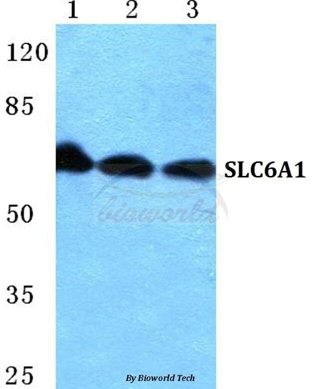 Anti-SLC6A1 Antibody