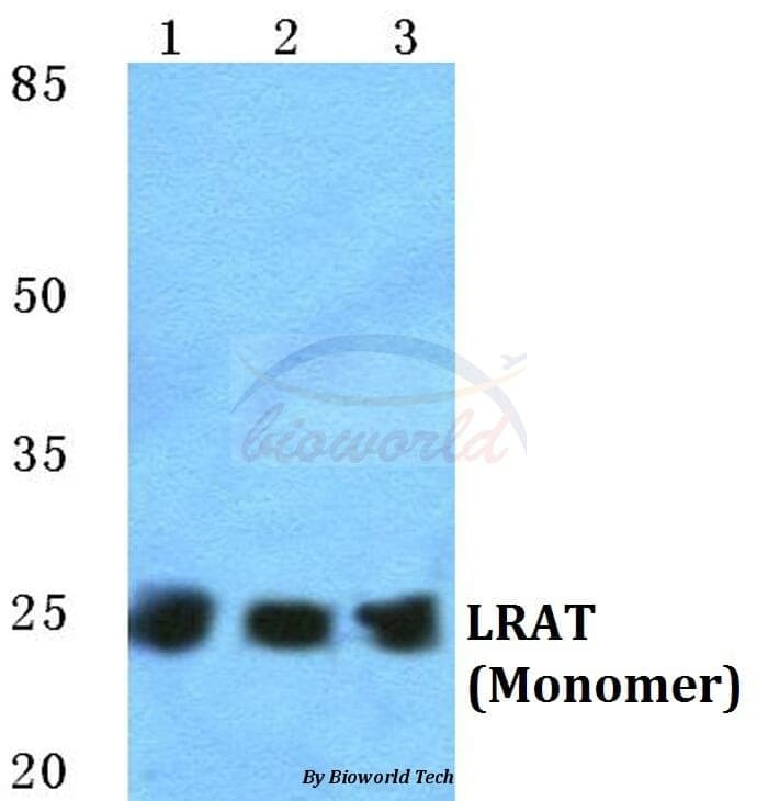 Anti-LRAT Antibody