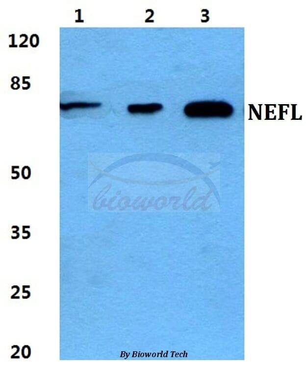 Anti-NEFL Antibody
