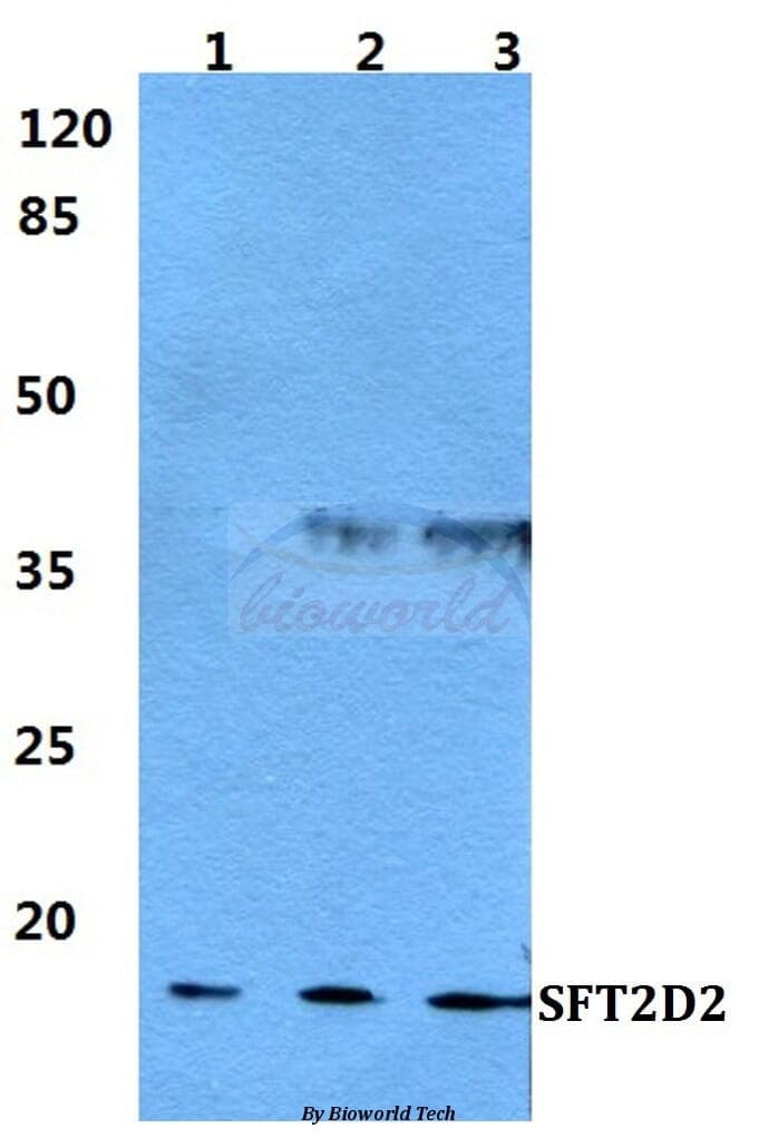 Anti-SFT2D2 Antibody