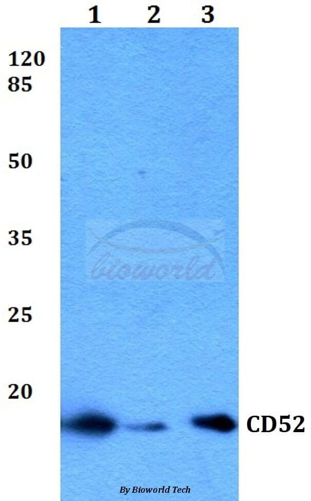 Anti-CD52 Antibody