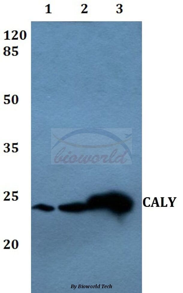 Anti-CALY Antibody