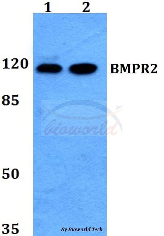 Anti-BMPR2 Antibody