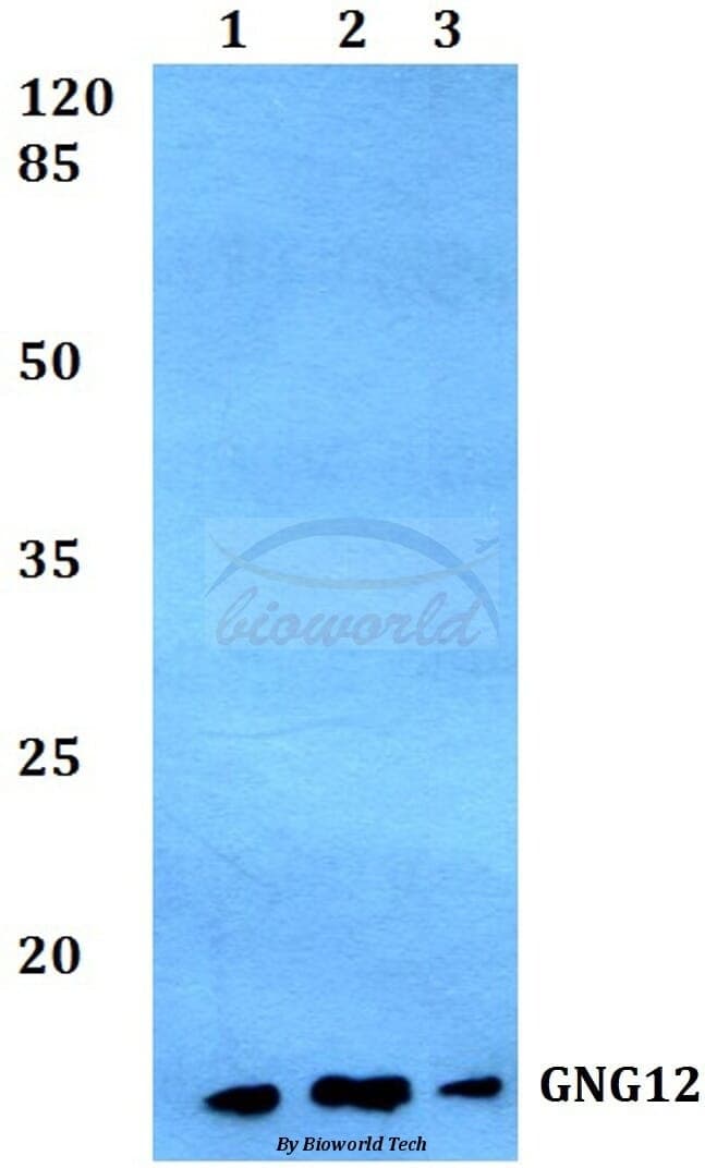 Anti-GNG12 Antibody