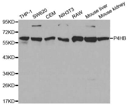 Anti-P4HB Antibody