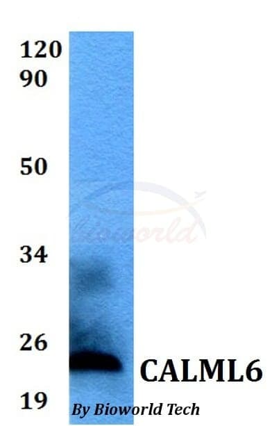 Anti-CALML6 Antibody