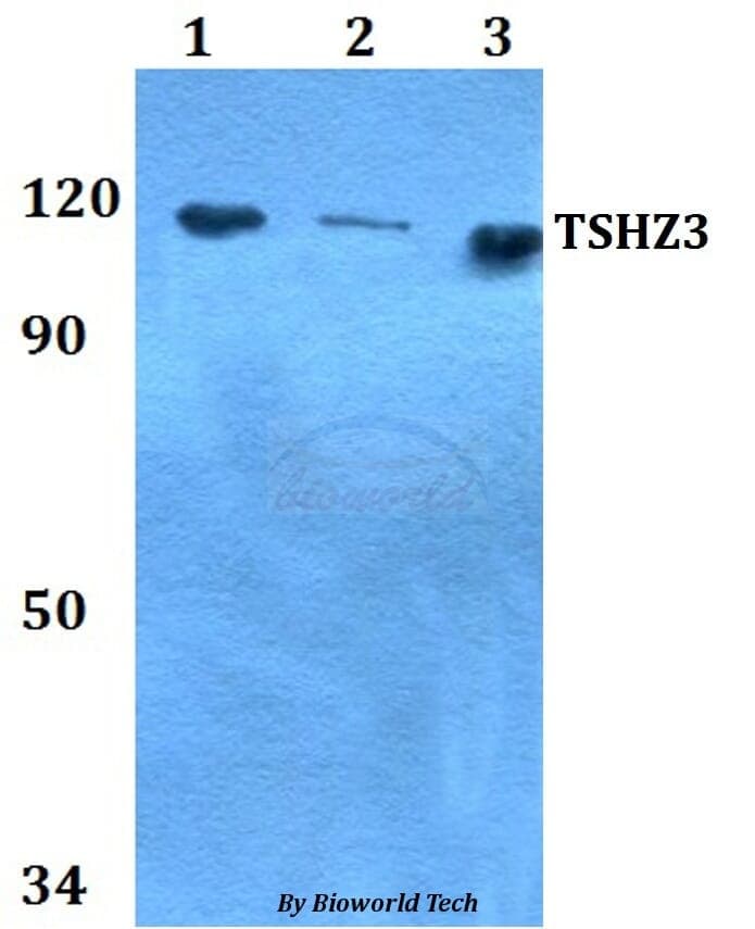 Anti-TSHZ3 Antibody