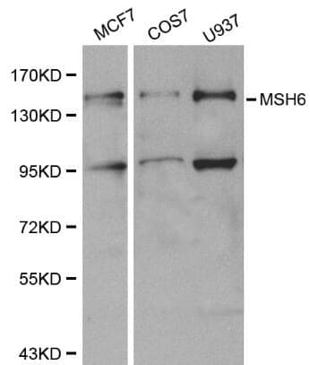 Anti-MSH6 Antibody