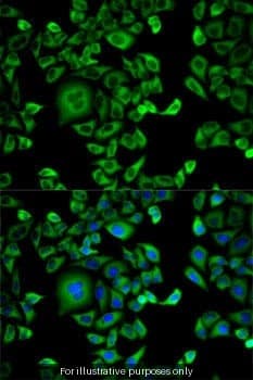 Human EXT1/Exostoses 1 ELISA Kit