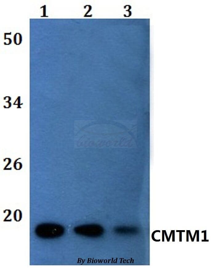 Anti-CMTM1 Antibody