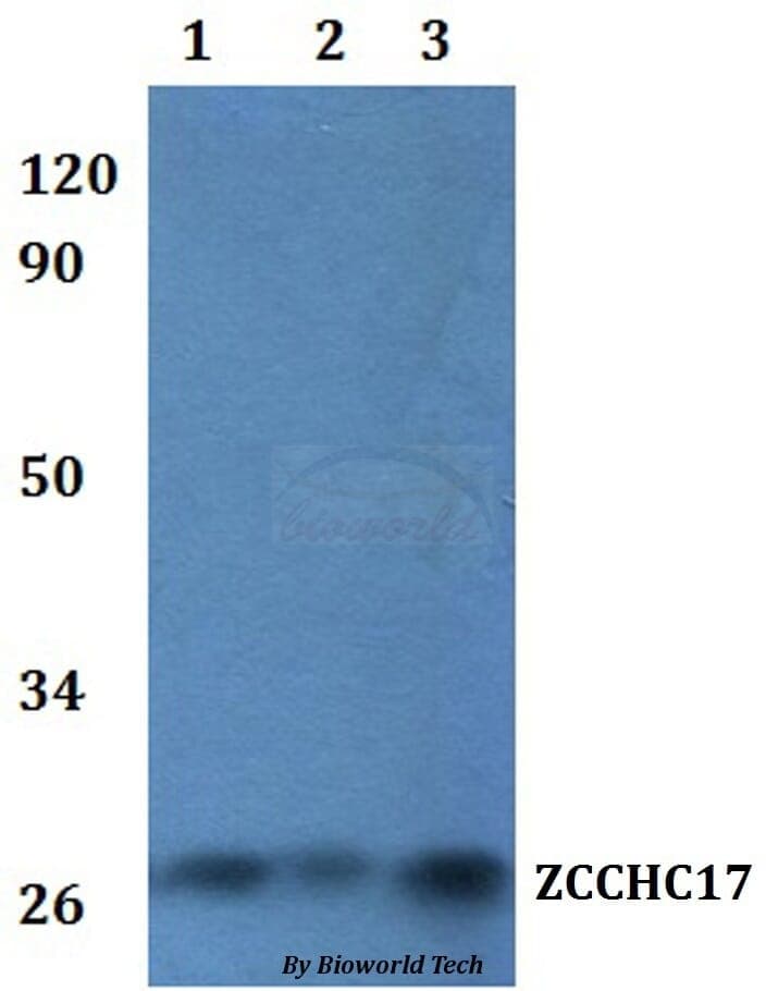 Anti-ZCCHC17 Antibody
