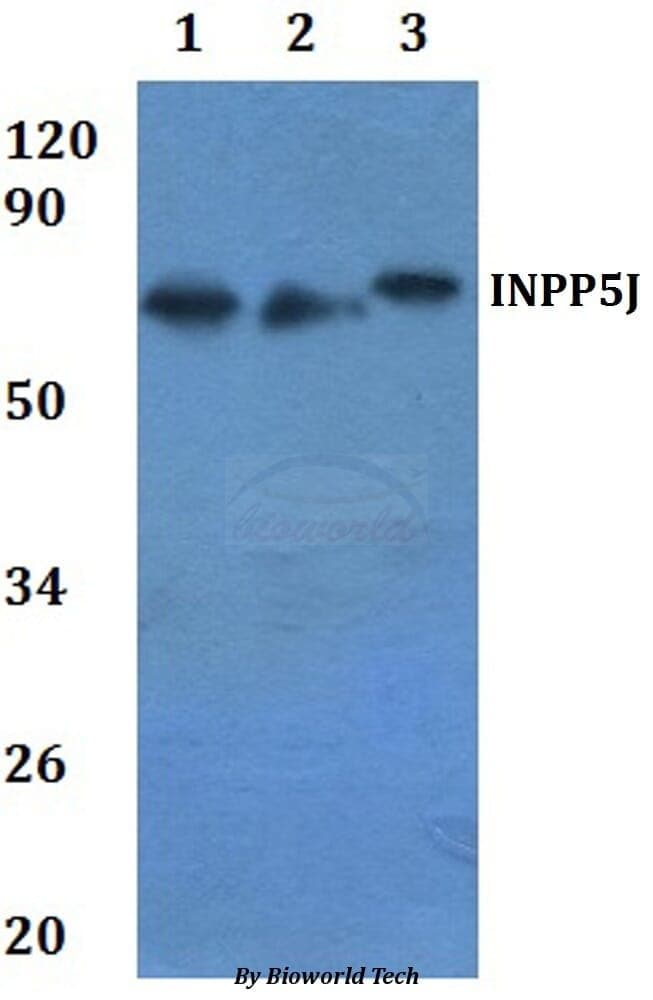 Anti-INPP5J Antibody