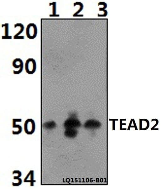 Anti-TEAD2 Antibody