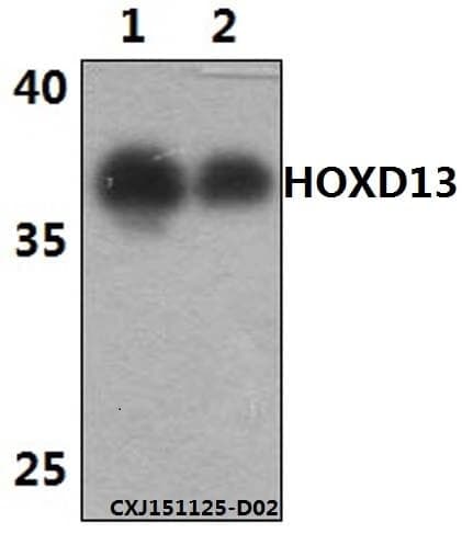 Anti-HOXD13 Antibody