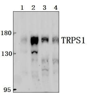 Anti-TRPS1 Antibody