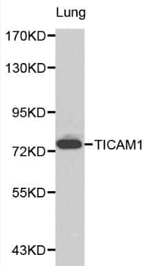 Anti-TICAM1 Antibody
