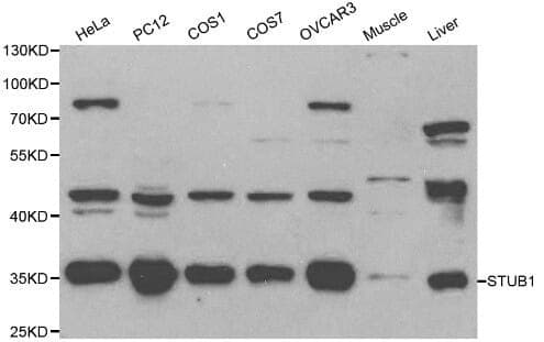 Anti-STUB1 Antibody