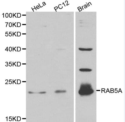 Anti-RAB5A Antibody