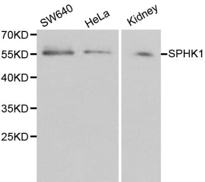 Anti-SPHK1 Antibody