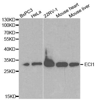 Anti-ECI1 Antibody
