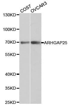 Anti-ARHGAP25 Antibody