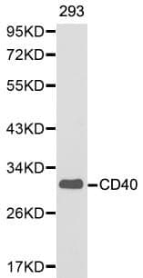 Anti-CD40 Antibody