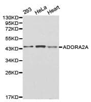 Anti-ADORA2A Antibody