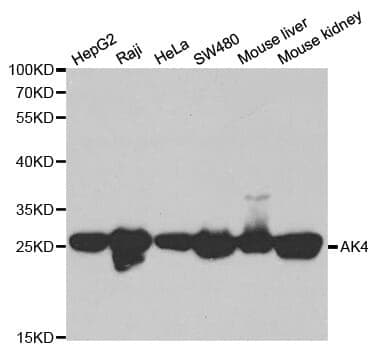 Anti-AK4 Antibody