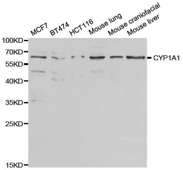 Anti-CYP1A1 Antibody
