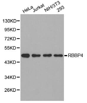Anti-RBBP4 Antibody