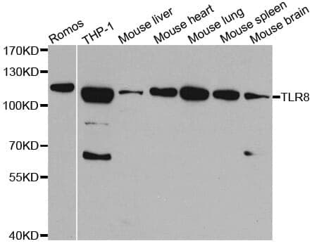 Anti-TLR8 Antibody