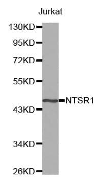 Anti-NTR1 Antibody
