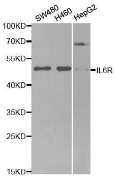 Anti-IL6R Antibody