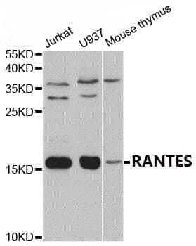 Anti-RANTES Antibody
