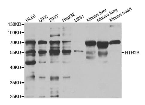 Anti-SR-2B Antibody