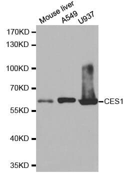 Anti-CES1 Antibody