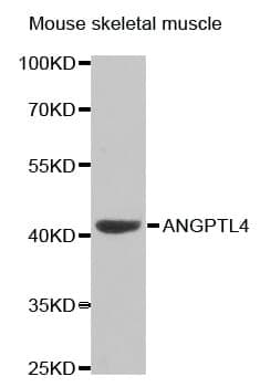 Anti-ANGPTL4 Antibody