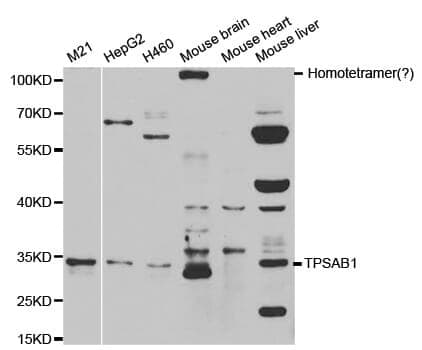 Anti-TPSAB1 Antibody
