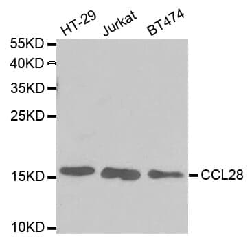 Anti-CCL28 Antibody