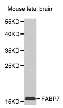 Anti-FABP7 Antibody