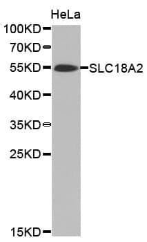 Anti-SLC18A2 Antibody