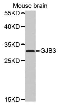 Anti-GJB3 Antibody