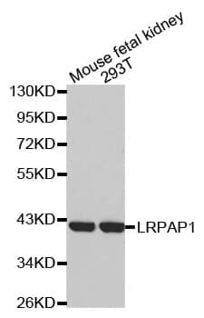 Anti-LRPAP1 Antibody