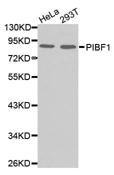 Anti-PIBF1 Antibody