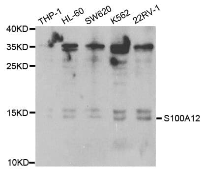 Anti-S100A12 Antibody