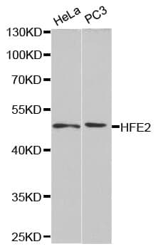 Anti-HFE2 Antibody