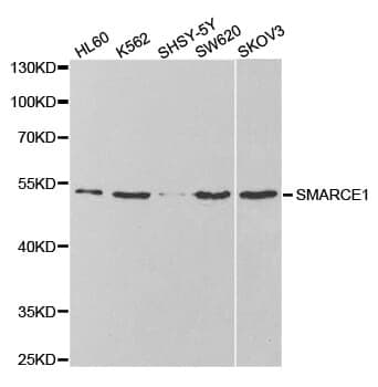Anti-SMARCE1 Antibody